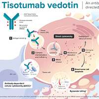 復(fù)發(fā)性宮頸癌 tisotumab vedotin二線或三線療效優(yōu)于化療