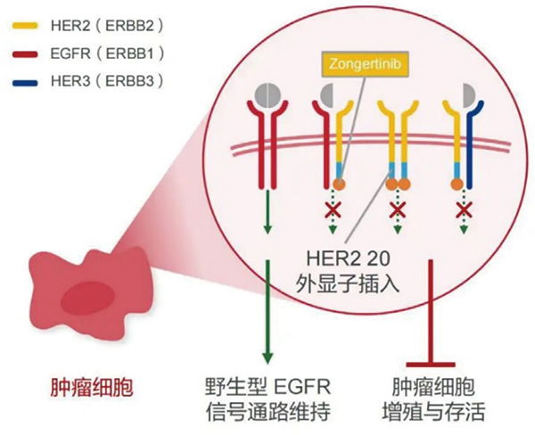 Zongertinib治療HER2陽性NSCLC研究公布