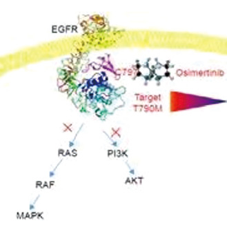 MET原發(fā)異常、EGFR突變的NSCLC 聯(lián)合賽沃替尼優(yōu)于奧希替尼單藥 