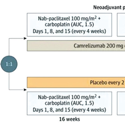 JAMA：復(fù)旦腫瘤“最毒乳腺癌”中國方案研究