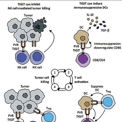 初治的、高PD-L1的晚期NSCLC 聯(lián)用tiragolumab對比單用阿替利珠單抗無明顯益處 